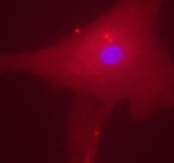 PAB12521 - MLXIPL