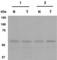 PAB12523 - Gliomedin