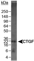 PAB12524 - CTGF