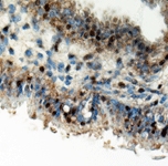 PAB12525 - CYR61