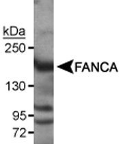 PAB12528 - FANCA