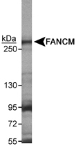 PAB12529 - FANCM