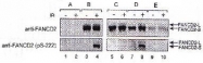 PAB12530 - FANCD2