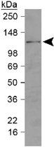 PAB12533 - IREB2