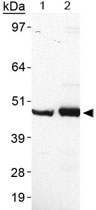PAB12542 - Perilipin-5