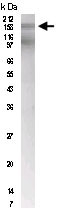 PAB12543 - PTCH1