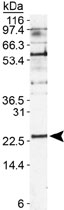 PAB12544 - PUMA