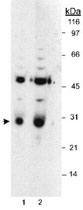 PAB12548 - HPGD