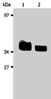 PAB1255 - AKT1 / PKB