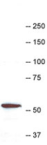PAB12563 - Coronin-1A