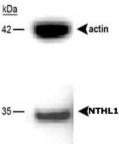 PAB12565 - NTH1