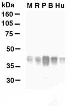 PAB12567 - Glutamine synthetase