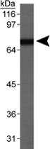 PAB12597 - SCARB1