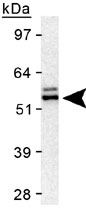 PAB12598 - TERF2