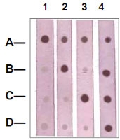 PAB12603 - Catenin beta-1