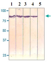 PAB12603 - Catenin beta-1