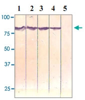 PAB12604 - Catenin beta-1