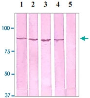 PAB12605 - Catenin beta-1
