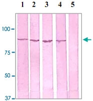 PAB12606 - Catenin beta-1