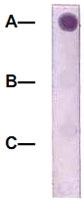 PAB12607 - Catenin beta-1