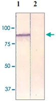 PAB12607 - Catenin beta-1
