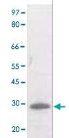 PAB12608 - Bcl-2