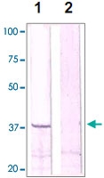 PAB12614 - CDK1