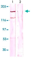 PAB12618 - CD115