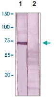 PAB12620 - Estrogen receptor alpha