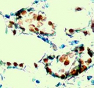 PAB12621 - Estrogen receptor alpha