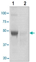 PAB12624 - GSK3 beta