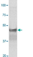 PAB12625 - GSK3 beta