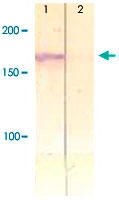 PAB12627 - IRS1