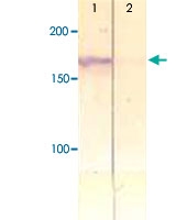 PAB12628 - IRS1