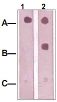 PAB12628 - IRS1