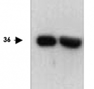 PAB12631 - LRP5