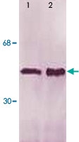 PAB12633 - LSP1 / WP34