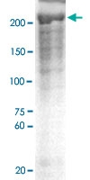 PAB12637 - Neurofibromin