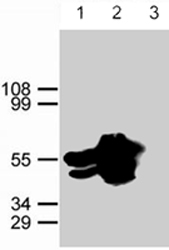 PAB1264 - GFP
