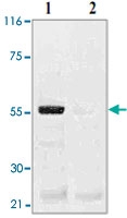 PAB12640 - TP53 / p53