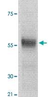PAB12641 - TP53 / p53