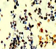 PAB12641 - TP53 / p53