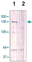 PAB12643 - ROCK2