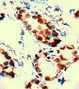 PAB12647 - CD309 / VEGFR-2 / Flk-1