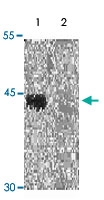 PAB12649 - ACTA2 / aortic smooth muscle Actin