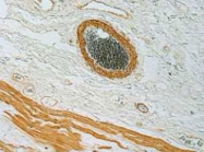 PAB12649 - ACTA2 / aortic smooth muscle Actin