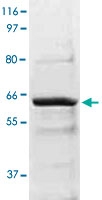 PAB12651 - AKT2 / PKB beta