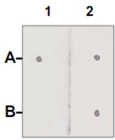 PAB12653 - Androgen receptor