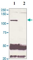 PAB12654 - Androgen receptor
