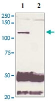 PAB12655 - Androgen receptor